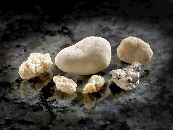 Ngừa sỏi thận từ chiết xuất thực vật