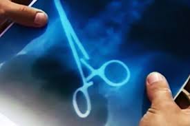 Đau nhói, đi khám phát hiện chiếc kéo nằm trong bụng 18 năm