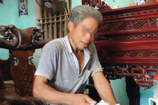 Người phụ nữ chặt tay, chân đang mang án môi giới mại dâm