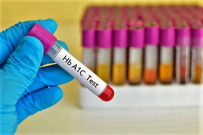 Tiền đái tháo đường: Những điều nên biết