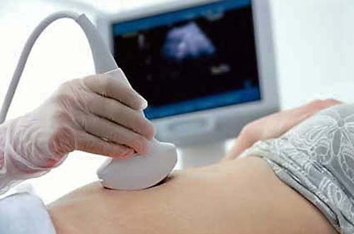 Gan nhiễm mỡ, những điều cần biết