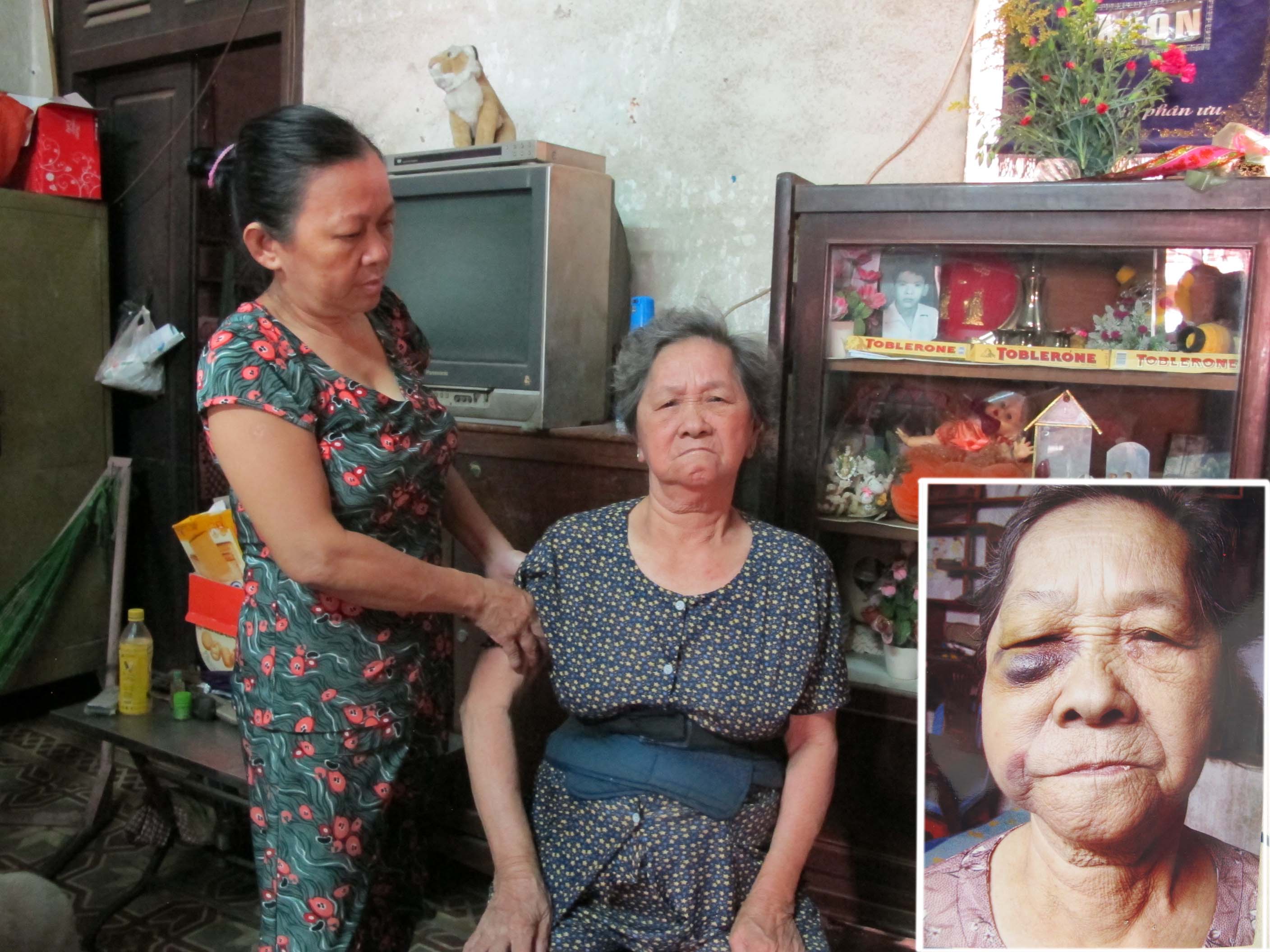 Mẹ “tố” bị con gái đánh