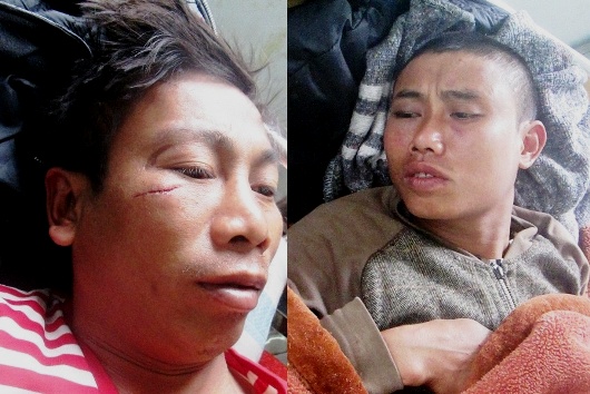 Bị phản đối giới thiệu vào HĐND xã, bí thư thôn liền đánh dân