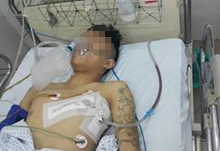 Thanh niên 18 tuổi bị đâm thấu ngực nghi do ghen tuông