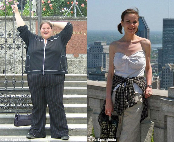 Chuyện cô gái giảm từ 187 kg xuống còn 49 kg