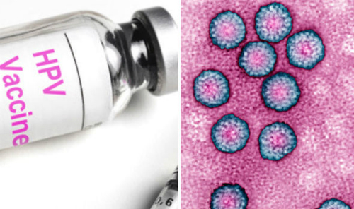 Vắc-xin HPV có vấn đề?