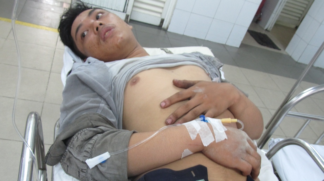 Kéo sắt vướng dây điện trung thế, 2 thợ xây bị bỏng nhập viện