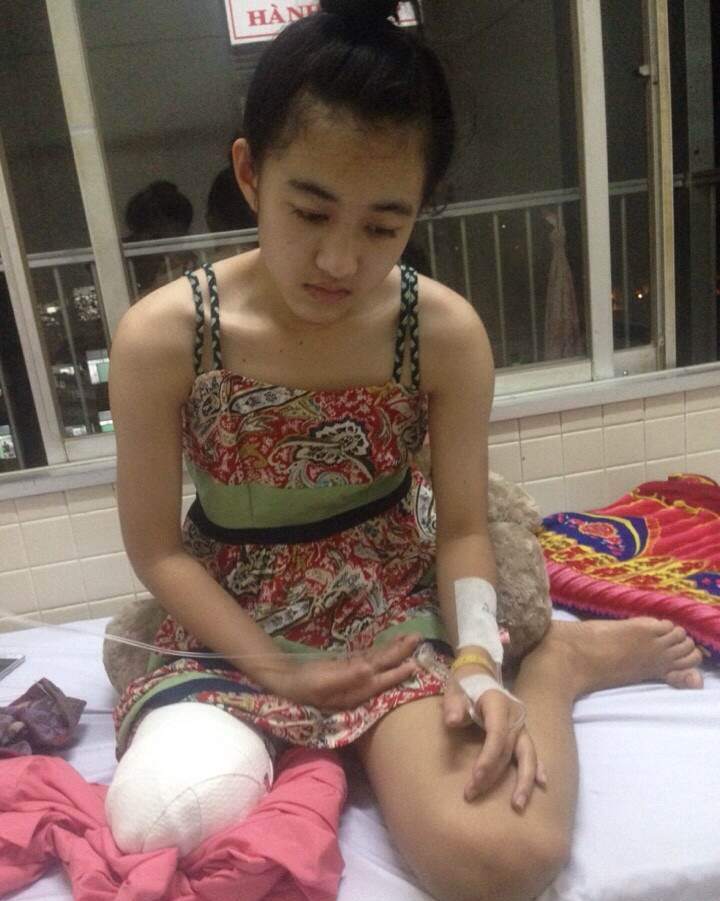 Công an làm việc với người nhà nữ sinh bị cưa chân