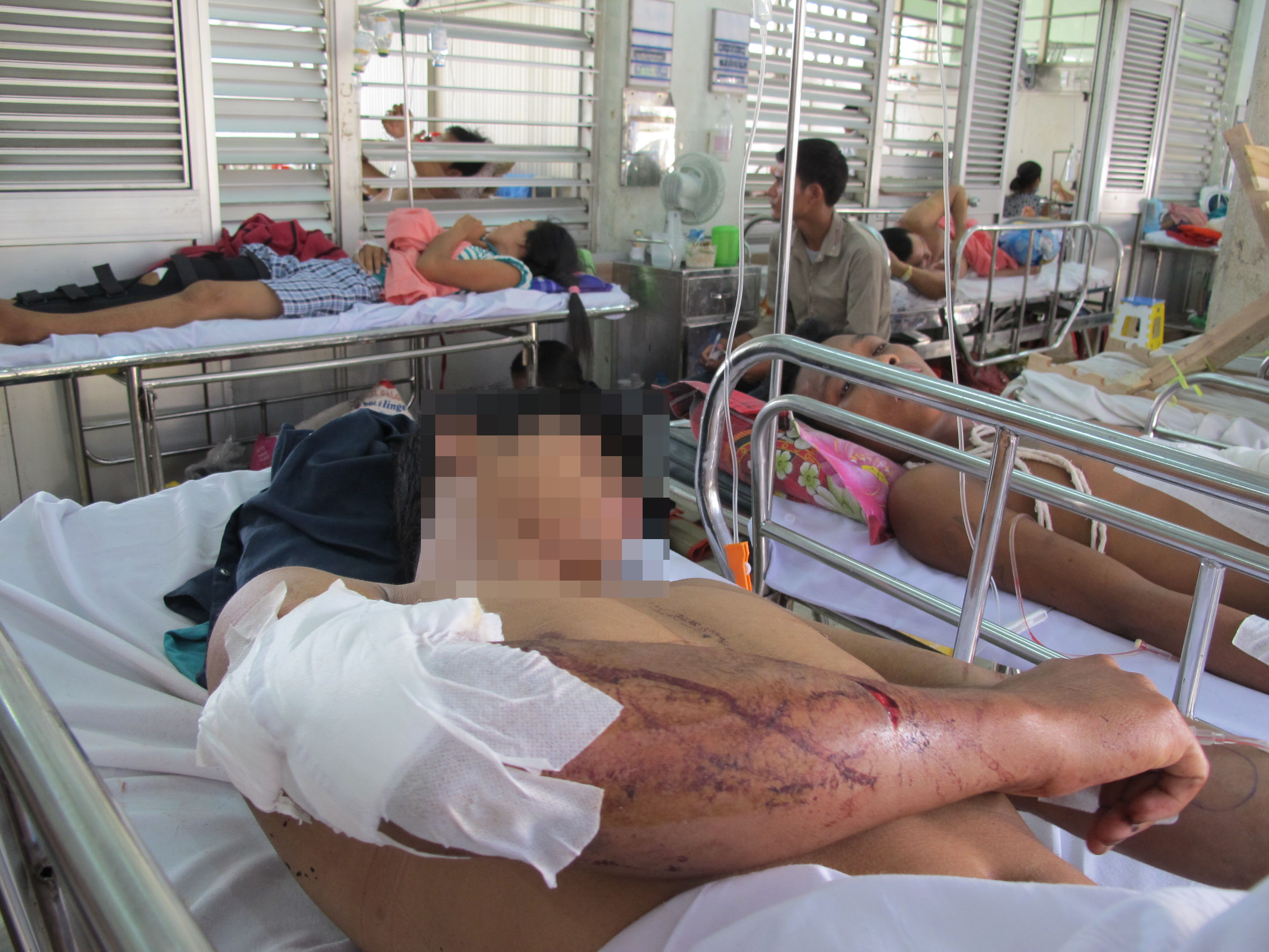 Yêu cầu Công an TPHCM xử nghiêm vụ chém 2 người ở bệnh  viện