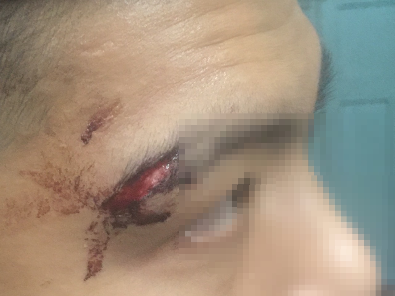 Công an quận 1 xác minh vụ công an phường bị tố đánh người