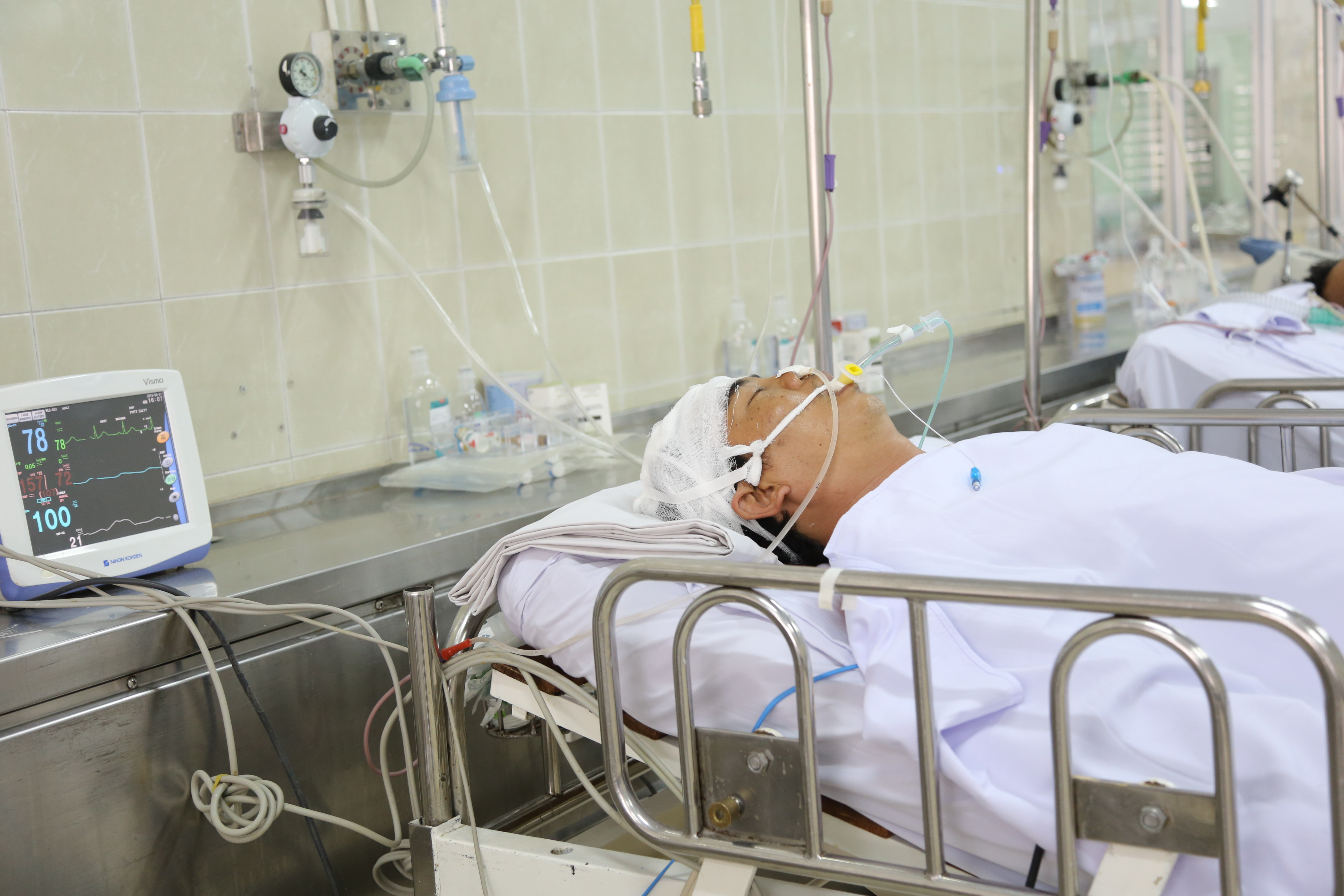 Tài xế vụ tai nạn đèo Prenn hôn mê, tiên lượng dè dặt