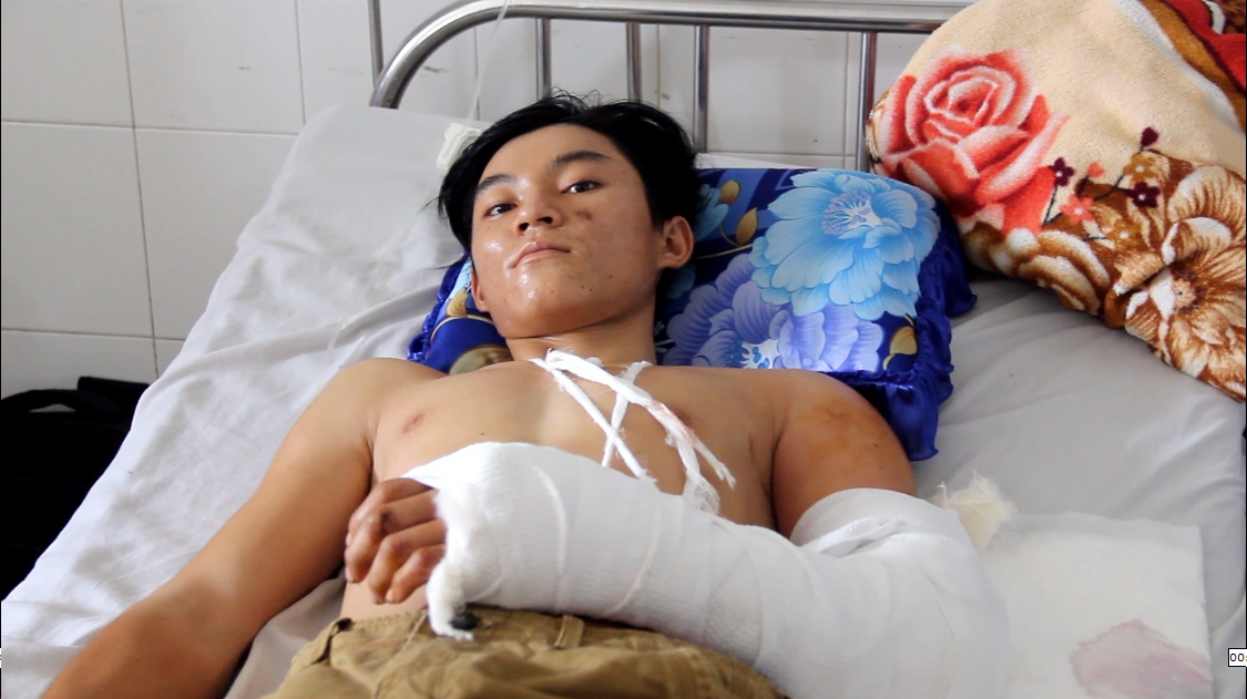 Nam thanh niên bị máy hút lúa “nuốt” cánh tay