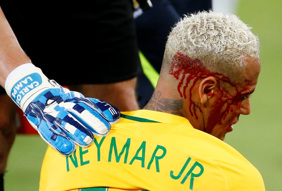 Neymar lại bị chỉ trích thiếu tôn trọng đối thủ