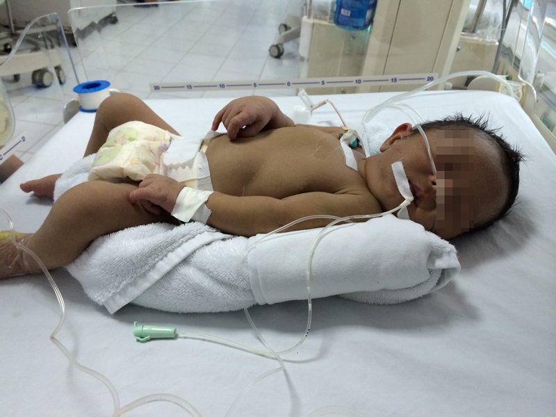 Uống nước thằn lằn và thuốc tàu, bé 20 ngày tuổi tử vong