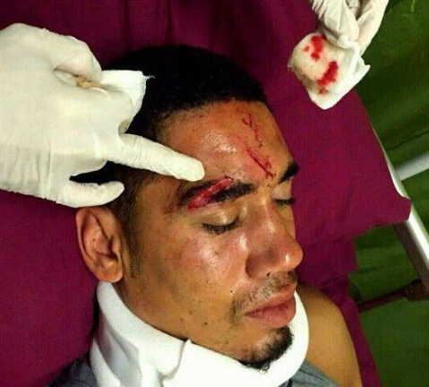 Ngộ độc thực phẩm, Smalling té xỉu vỡ đầu
