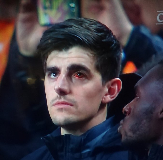 Bị đau mắt đỏ, Courtois ngồi ngoài trận Bỉ hòa Hà Lan