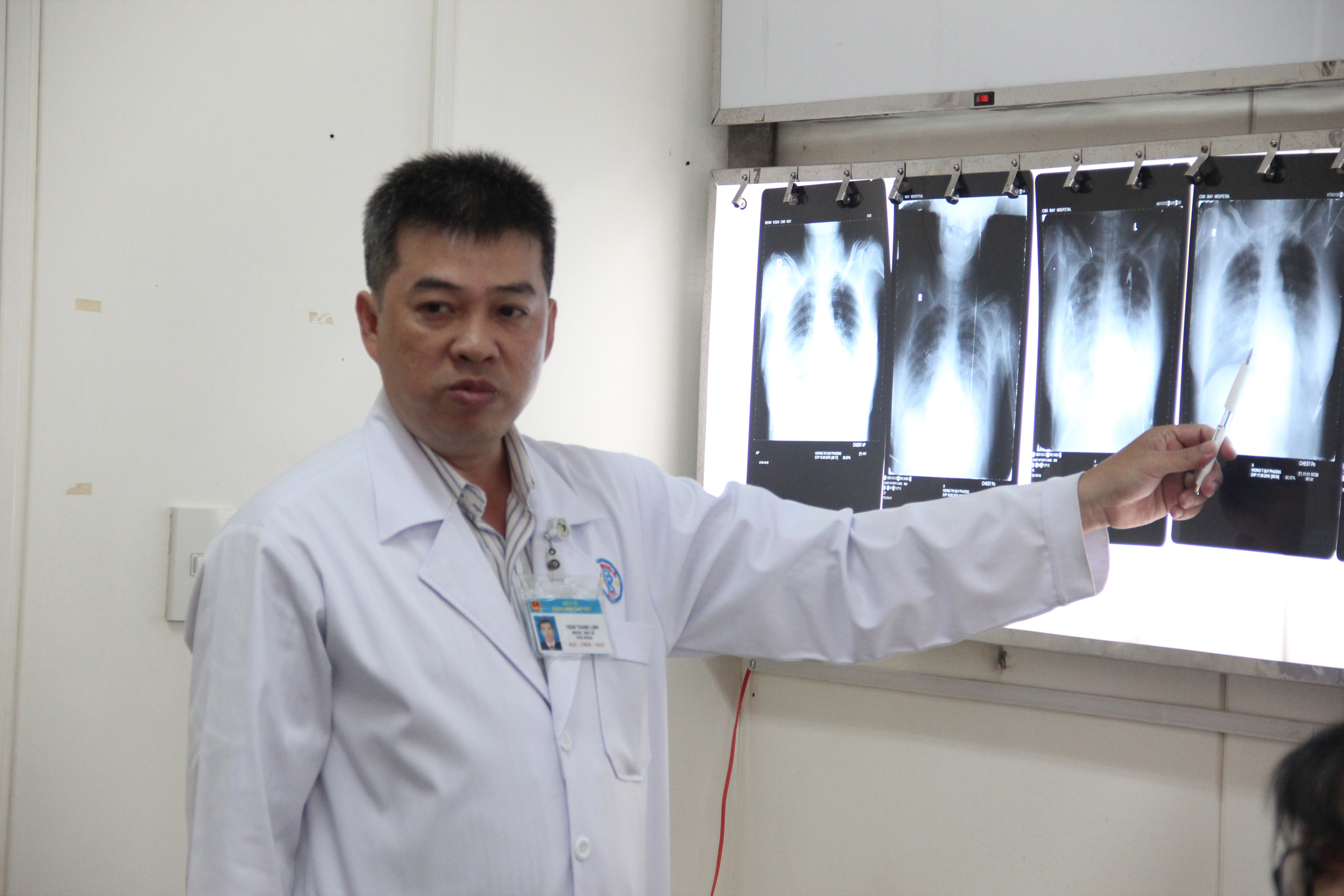 Lần đầu tiên các bác sĩ Bệnh viện Chợ Rẫy gặp phải ca bệnh lạ này.