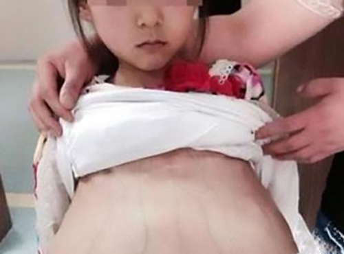 Cô bé không được tiết lộ tên, được chồng và mẹ chồng đưa đi khám thai. Ảnh: AsiaWire