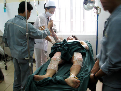 Có được trả lương khi điều trị tai nạn lao động?