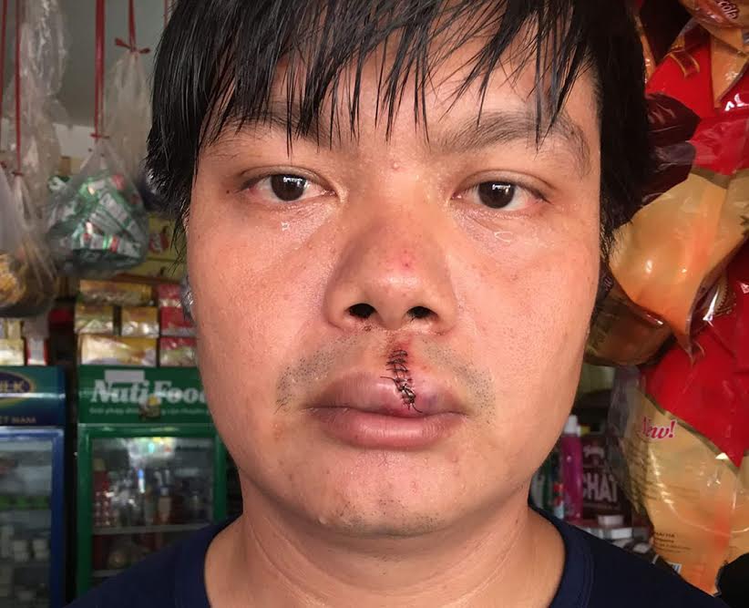 Xông vào nhà đập phá, hành hung người tố cáo ô nhiễm?