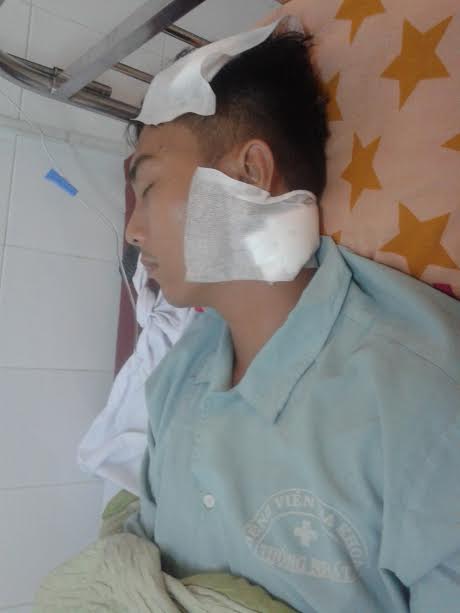 Đang ngồi chơi, bị 20 côn đồ xông vào truy sát