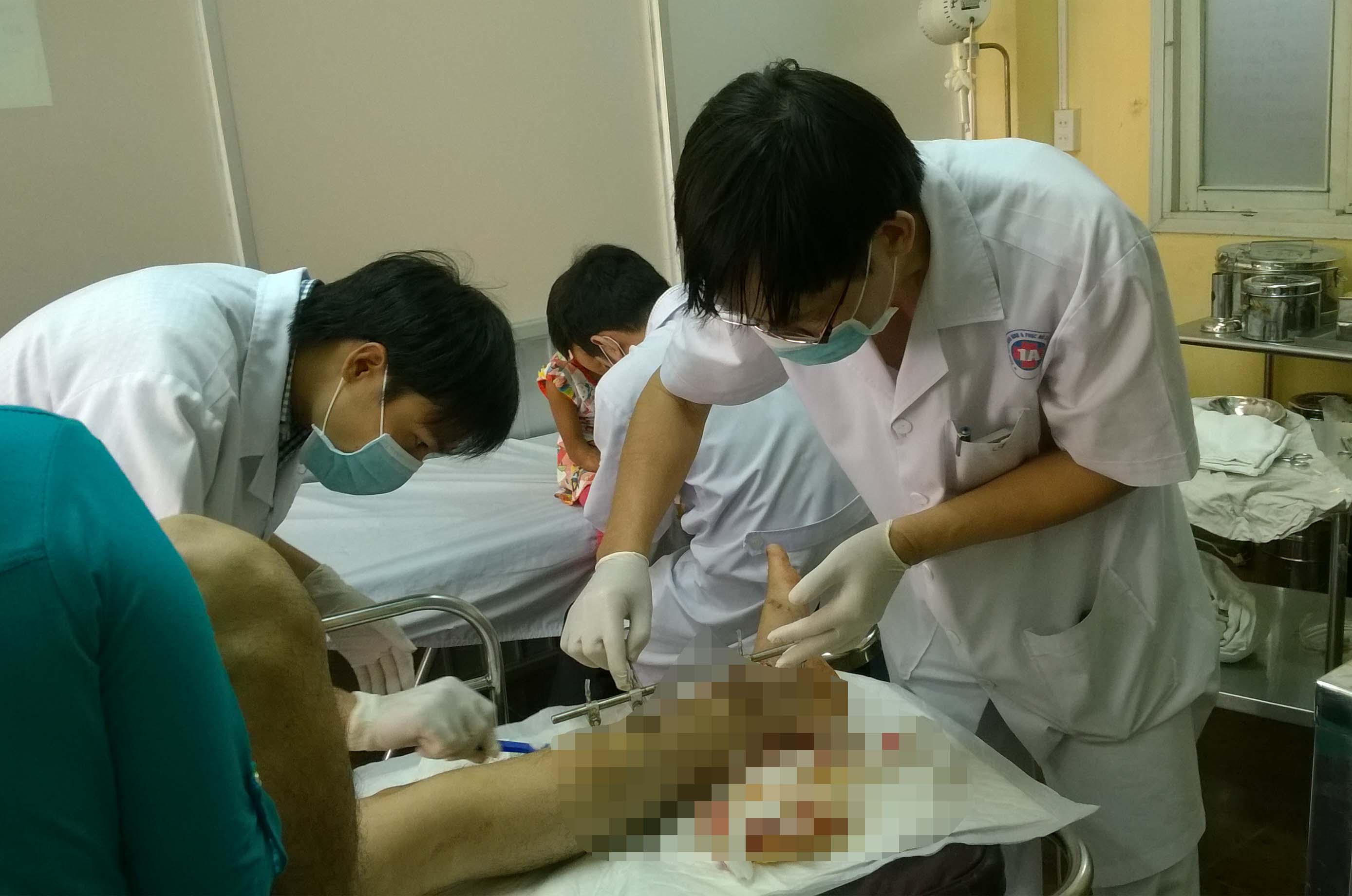 Một công nhân thoát cảnh cưa chân vì xương dập nát