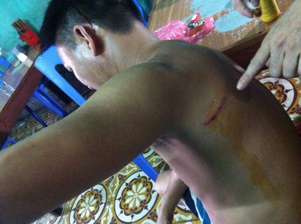 Côn đồ đất mỏ truy sát nhà xe, 1 người dân vô cớ bị chém - Ảnh 1.