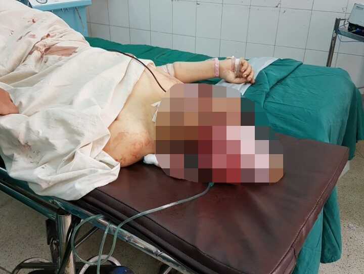 Nghi án chồng chém vợ vỡ sọ rồi tự sát