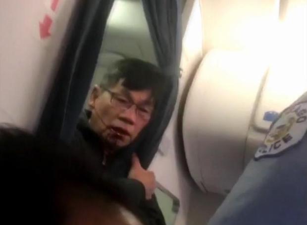 Bác sĩ gốc Việt bắt đầu đưa United Airlines ra tòa