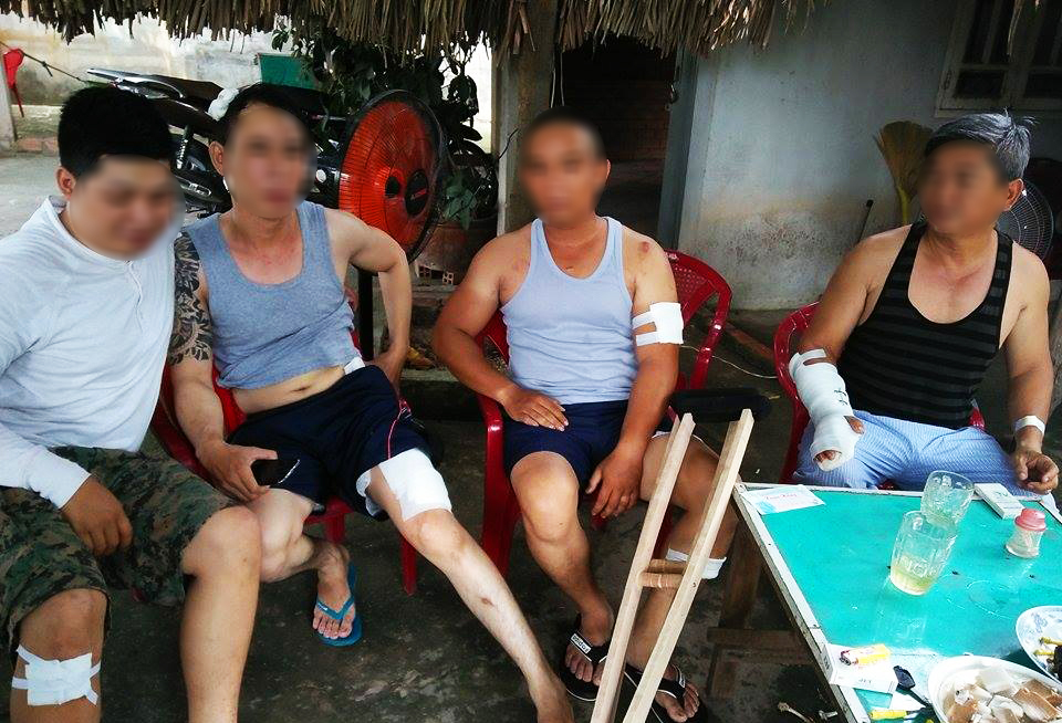 Nhóm giang hồ lao vào nhà truy sát, 4 người nhập viện cấp cứu - Ảnh 1.