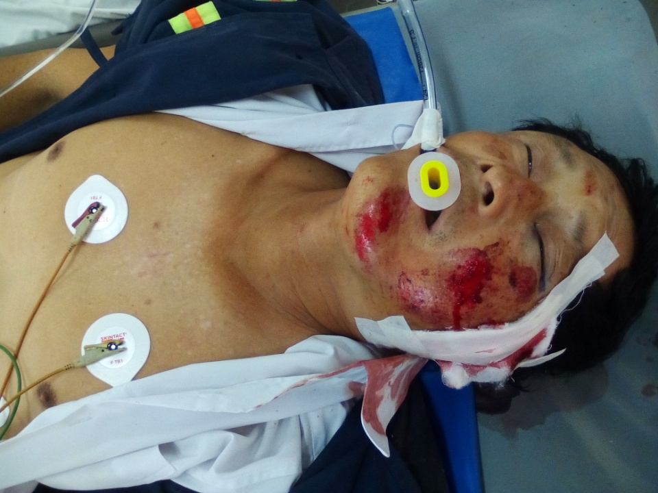 Tìm thân nhân của người đàn ông bị TNGT nguy kịch
