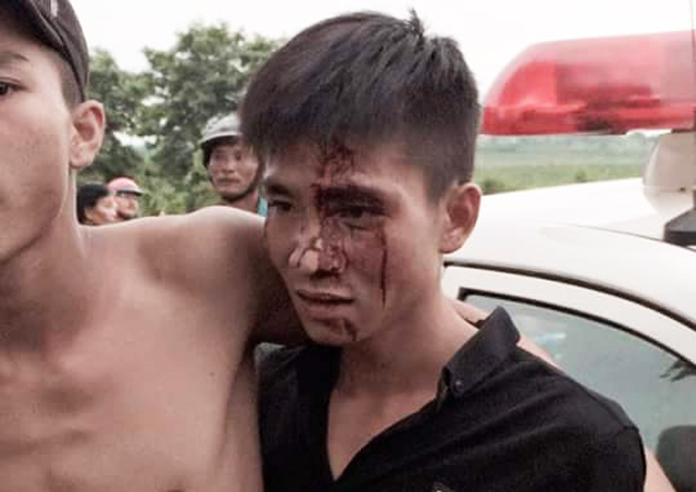 Xác minh thông tin người dân tố công an đánh người