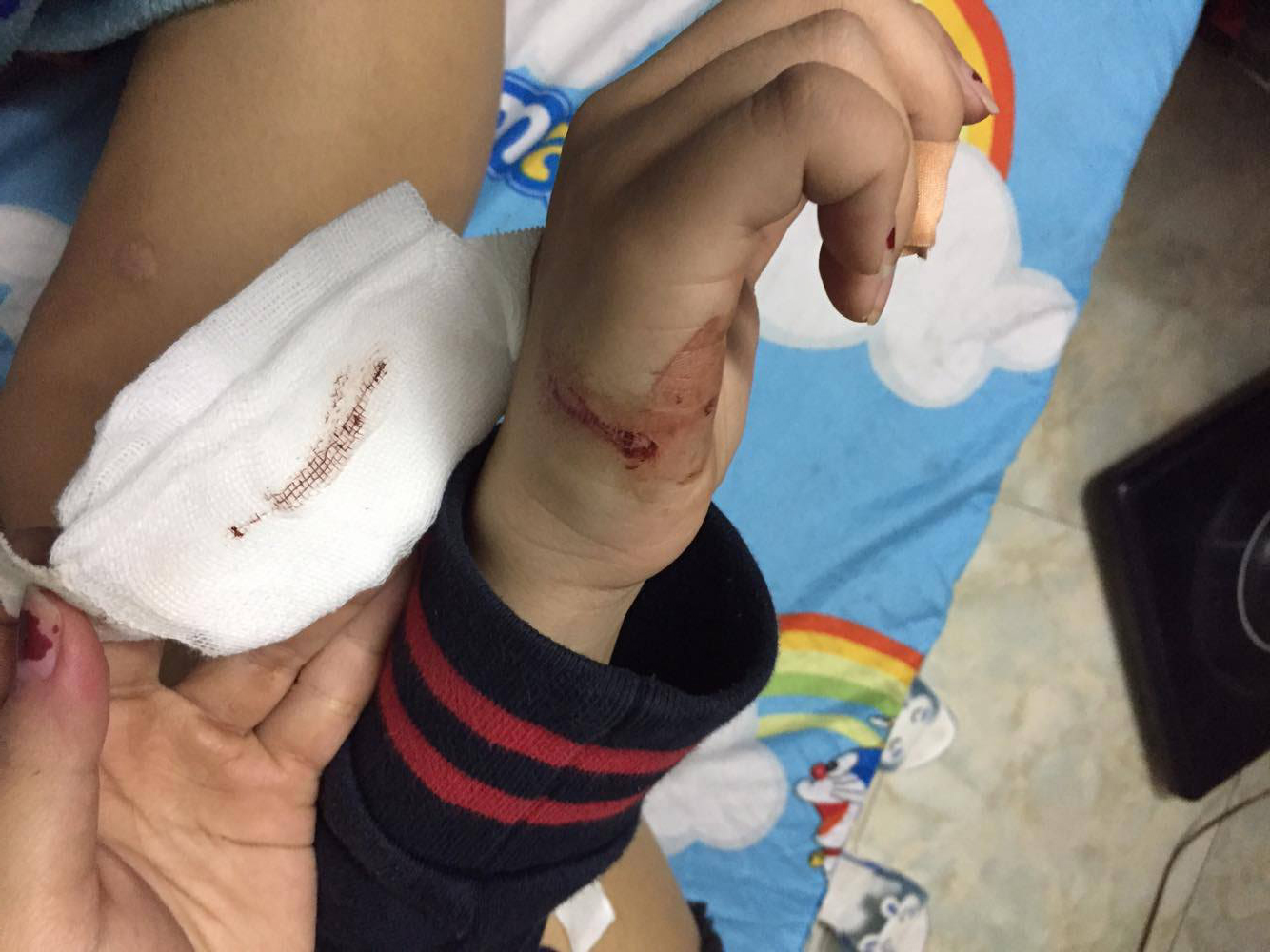 Trước khi bị rạch dao lam l&ecirc;n người H. bị một nh&oacute;m thanh ni&ecirc;n s&agrave;m sỡ.