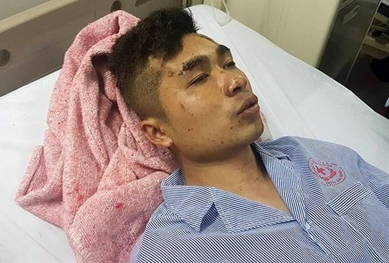 Anh Nông Đức Thương bàng hoàng kể về thời điểm vụ nổ xe khách