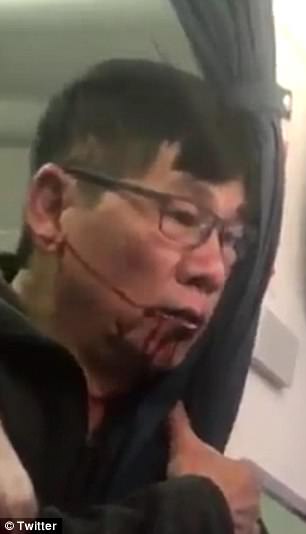Sau vụ bác sĩ gốc Việt, United Airlines chi mạnh tay