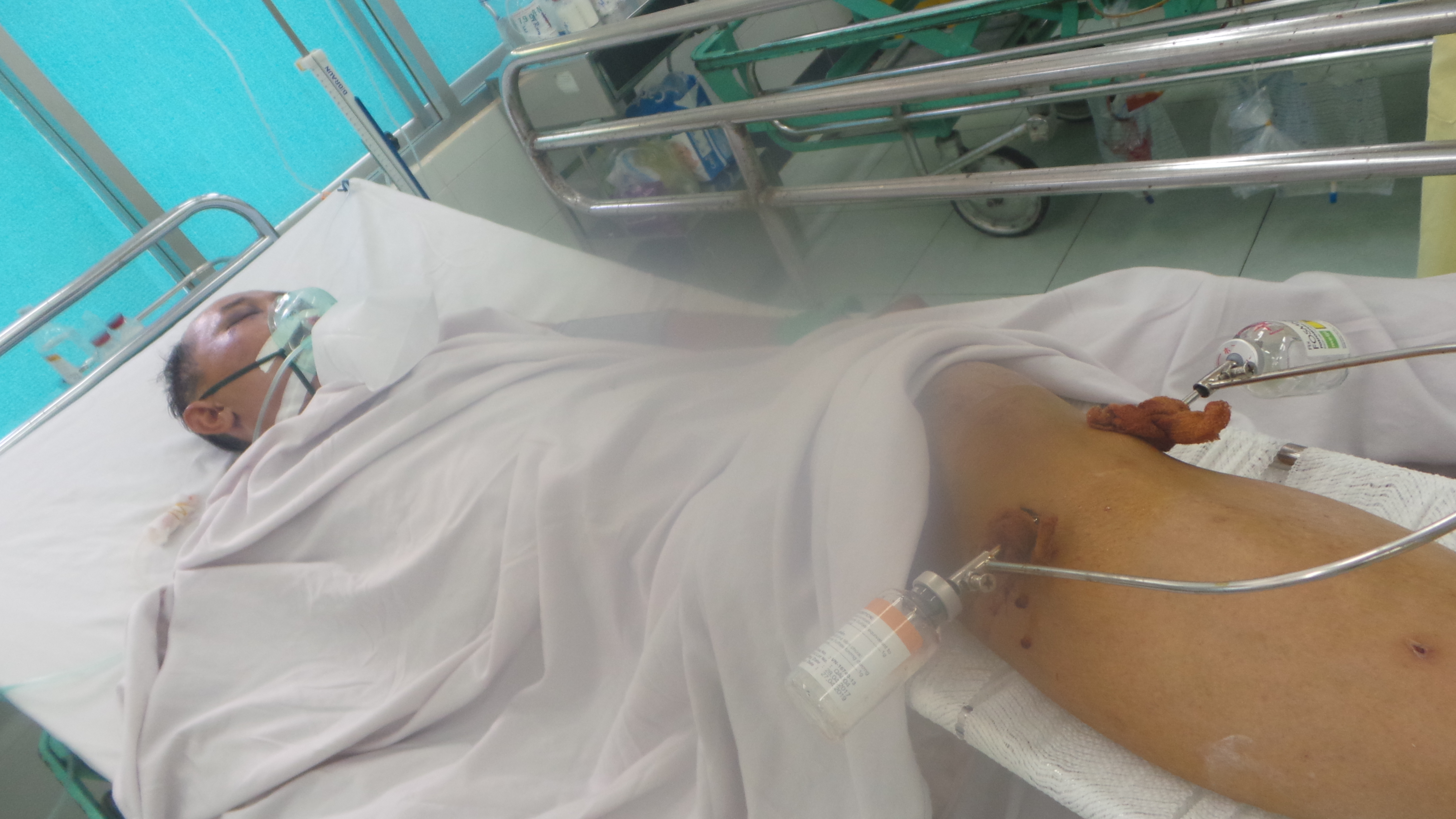Cứu sống thợ hồ t&eacute; gi&agrave;n gi&aacute;o cao 5 m&eacute;t - Ảnh 1.