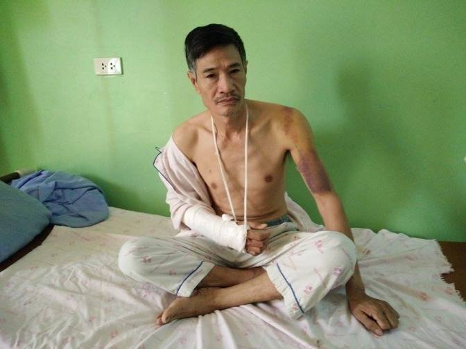 Bảo vệ cây trứng cá, 2 vợ chồng bị đánh nhập viện - Ảnh 2.