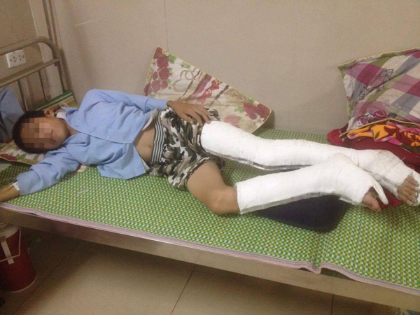 C&ocirc; gi&aacute;o thu điện thoại, nam sinh nhảy từ tầng 3 xuống đất - Ảnh 2.