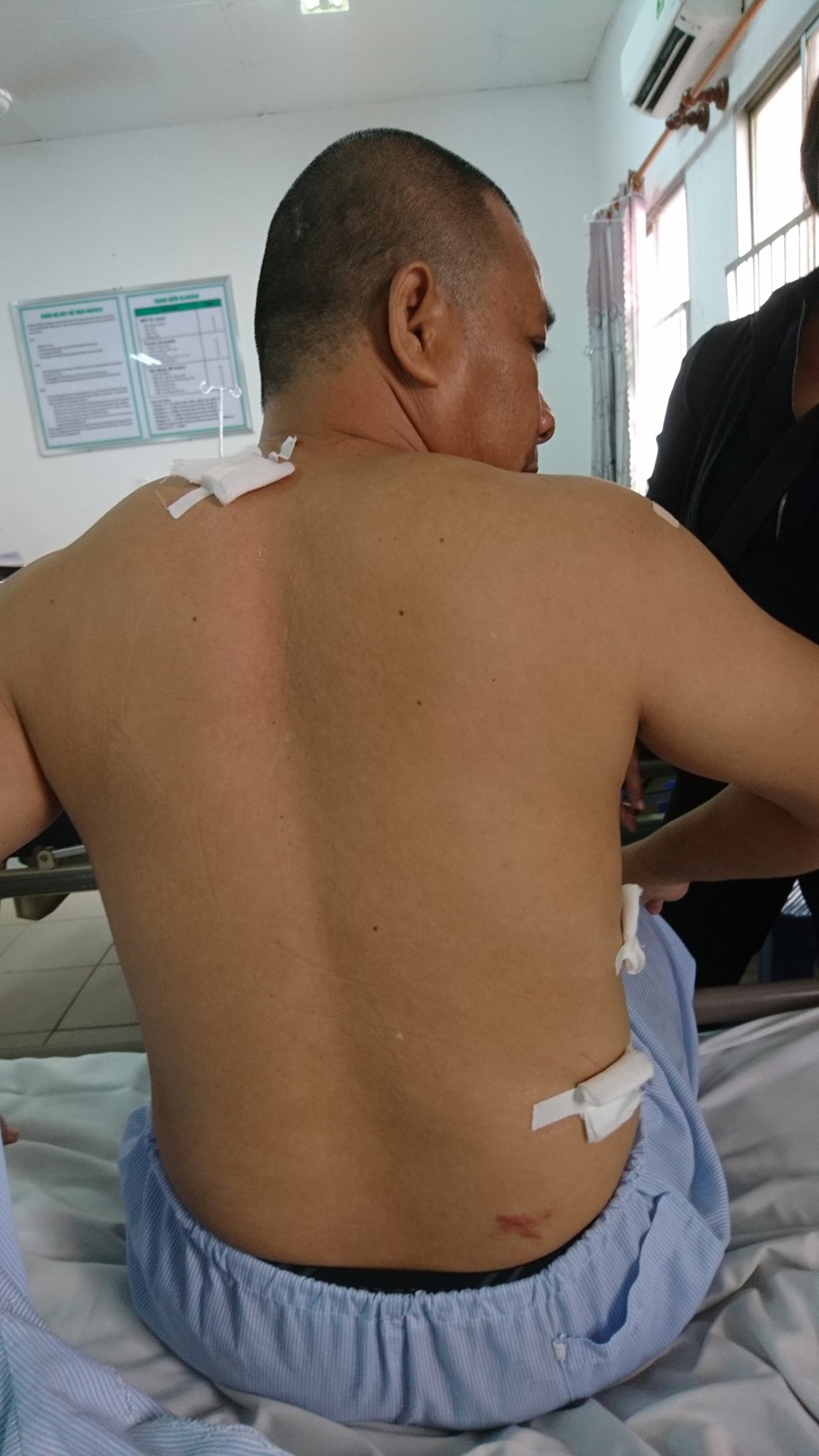 Vô cớ đâm người trọng thương, còn kéo vào bệnh viện gây rối