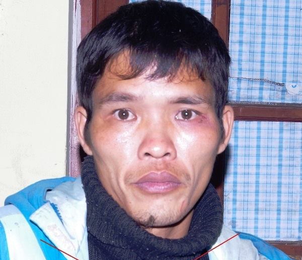 Đòi quan hệ tình dục không được, cầm gạch đập chết bạn gái