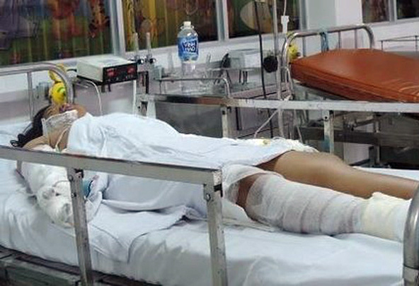 TP HCM: Tưới xăng đốt bạn gái vì bị đòi chia tay