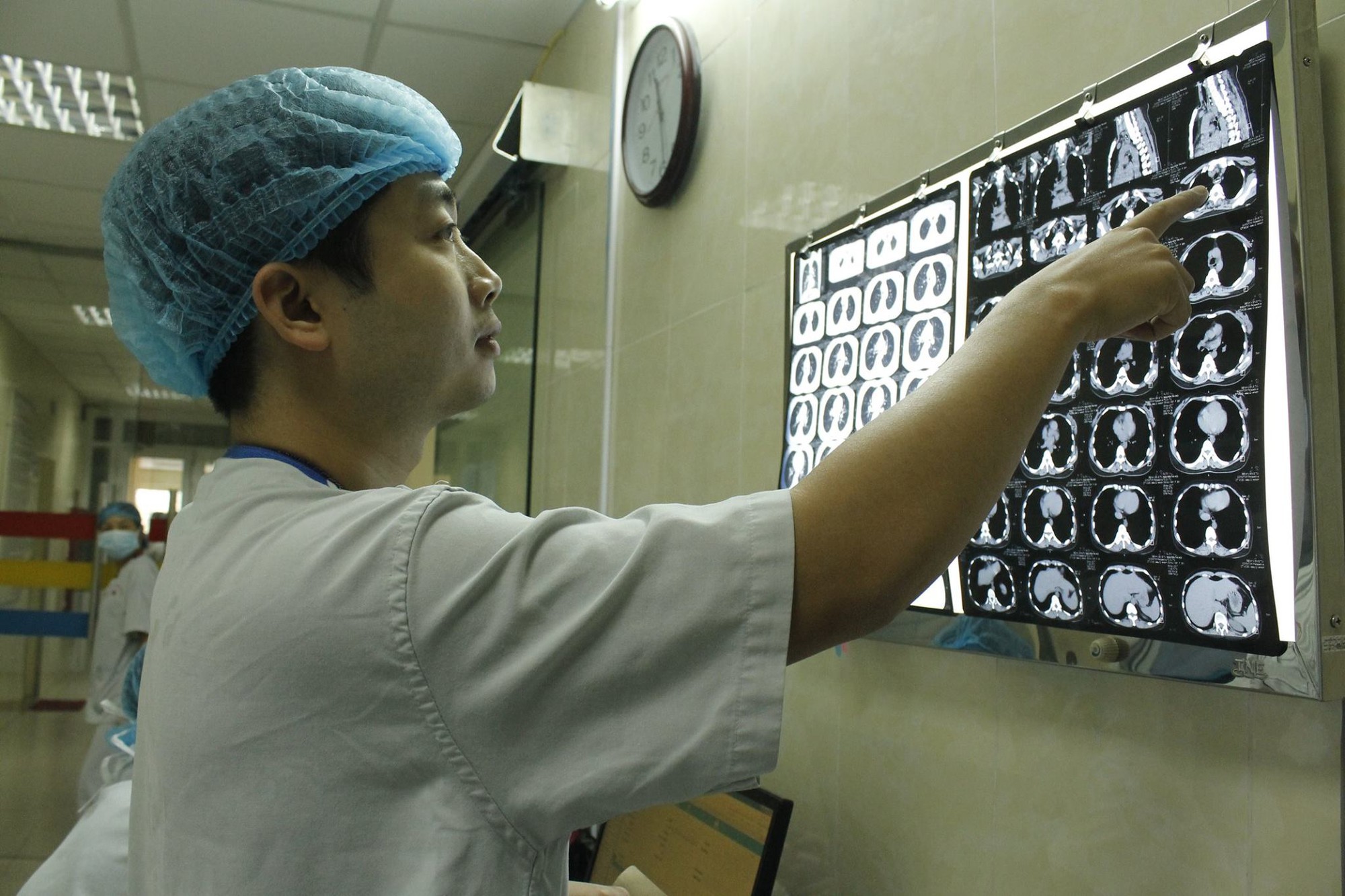 Hóc xương gà mà tự chữa, 1 phụ nữ suýt chết