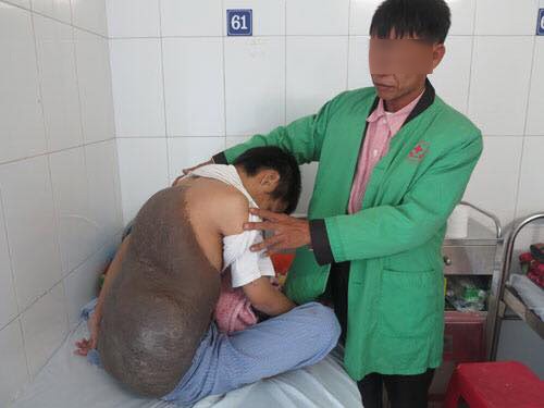 Kinh h&atilde;i với tấm mai r&ugrave;a lớn cắt ra từ lưng người thanh ni&ecirc;n - Ảnh 2.