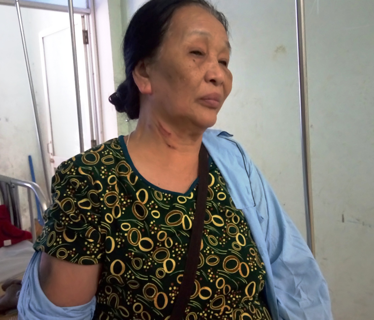 Kỷ luật thầy giáo say rượu đánh vợ chồng cựu binh nhập viện