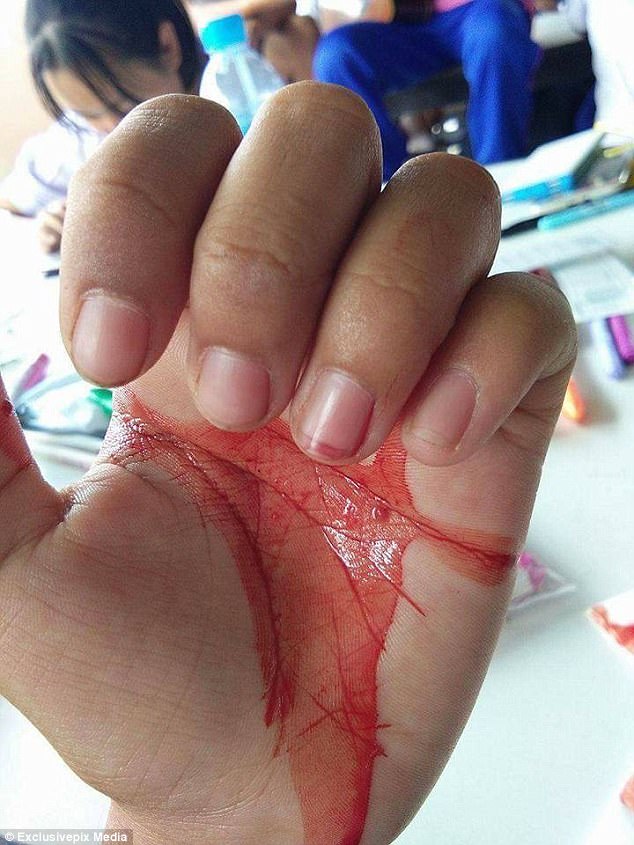 B&eacute; g&aacute;i chảy m&aacute;u mắt, mũi, tai khi đau đầu - Ảnh 1.