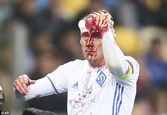 Không chiến nảy lửa, sao Dynamo Kiev vỡ đầu