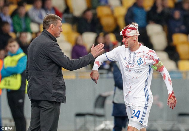 Kh&ocirc;ng chiến nảy lửa, sao Dynamo Kiev vỡ đầu - Ảnh 4.