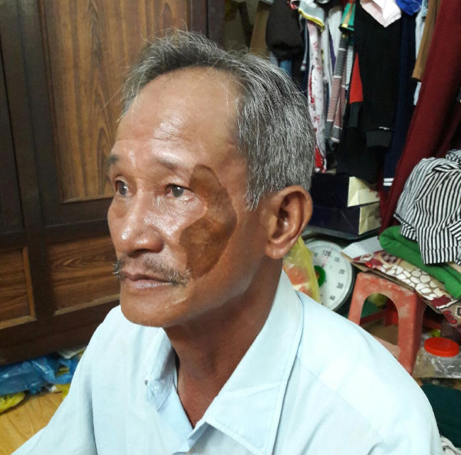Đòi công lý vì bị chém do tố cáo