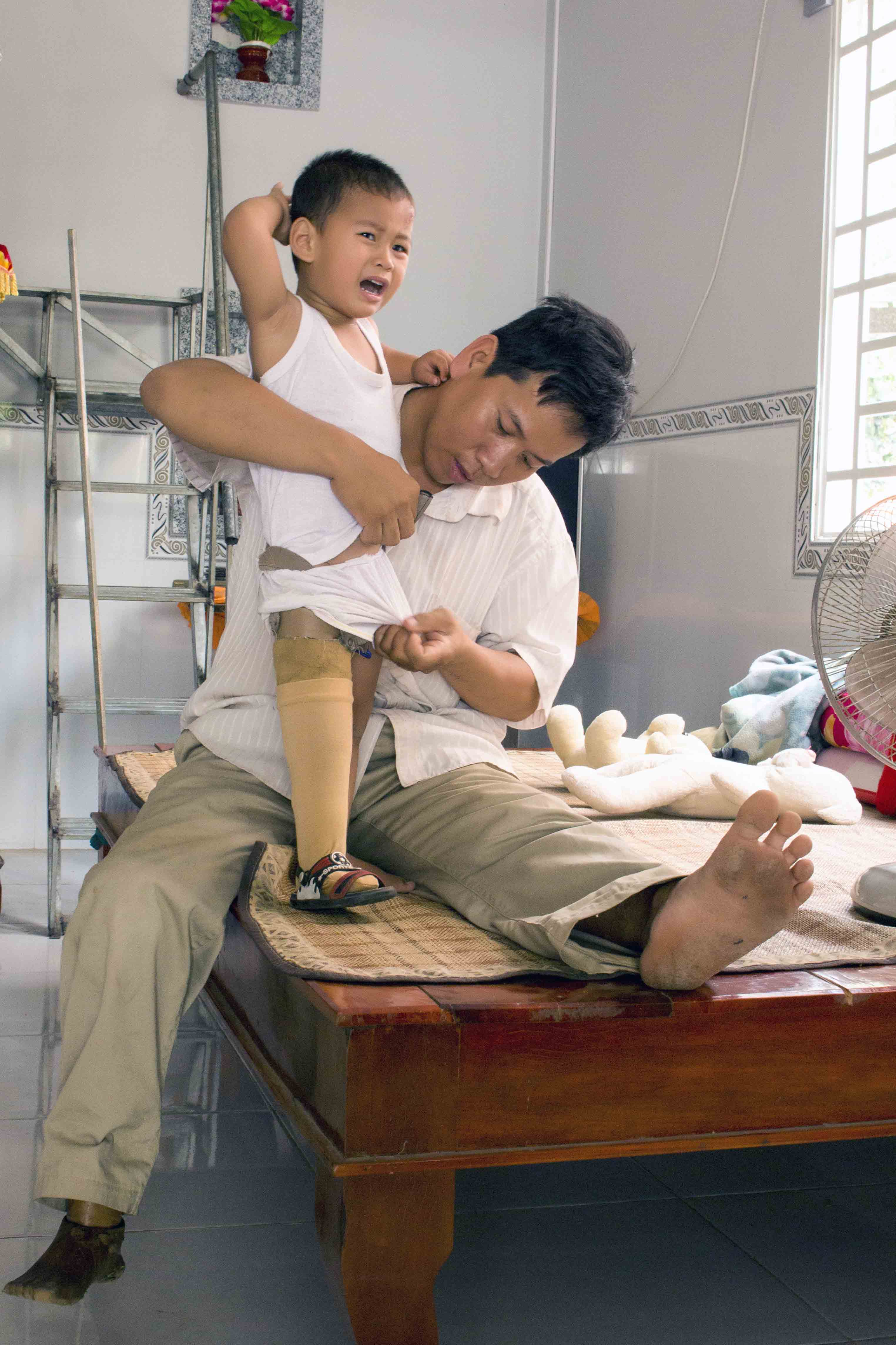 Đôi chân giả khiến bé Huy đôi khi cảm thấy khó chịu