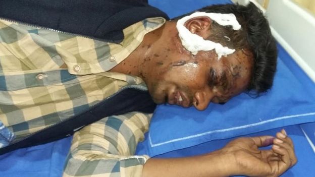 
&Ocirc;ng Jayakumar Purushottam, 32 tuổi, l&agrave; nạn nh&acirc;n nam hy hữu bị nữ giới tạt axit v&igrave; t&igrave;nh. Ảnh: BBC

